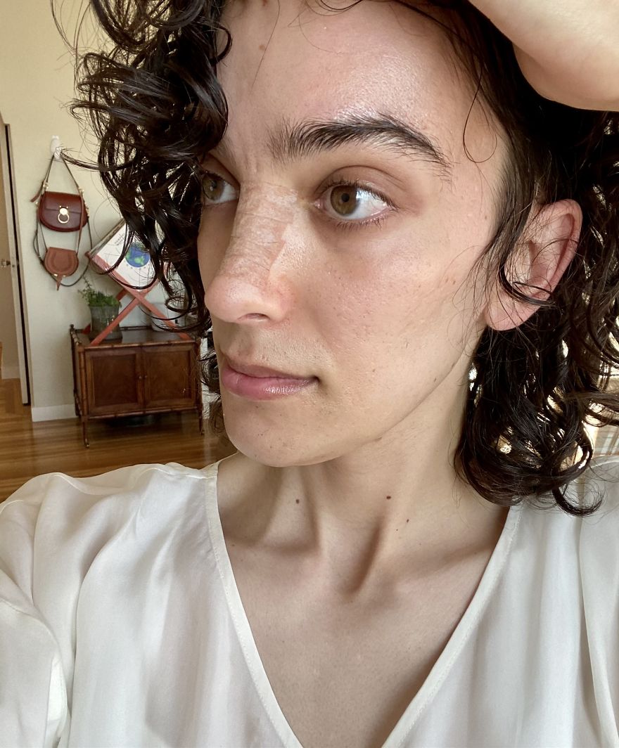 Woman Reveals Her Transition Photos After Taking Hormones For 14 Months Woman Reveals Her Transition Photos After Taking Hormones For 14 Months