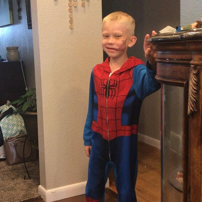 6-Year-Old Superhero Saves Sister From Dog Attack, Gets 90 Stitches And Praise From The Avengers 6-Year-Old Superhero Saves Sister From Dog Attack, Gets 90 Stitches And Praise From The Avengers