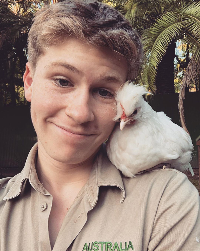 Robert Irwin Gets Bitten In The Face By A Snake, Happily Poses For A Photo Afterwards Robert Irwin Gets Bitten In The Face By A Snake, Happily Poses For A Photo Afterwards