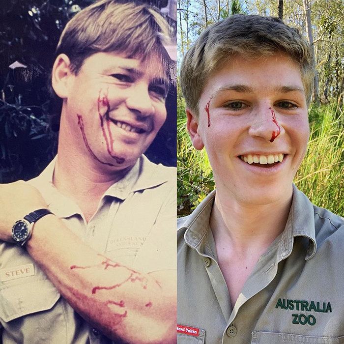 Robert Irwin Gets Bitten In The Face By A Snake, Happily Poses For A Photo Afterwards Robert Irwin Gets Bitten In The Face By A Snake, Happily Poses For A Photo Afterwards