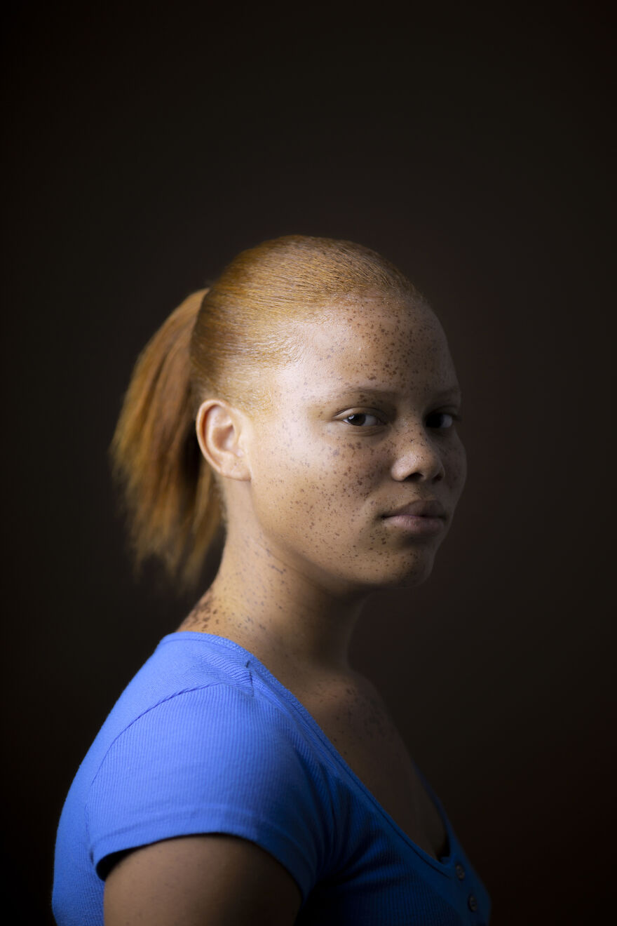 Photographer Has Been Capturing Gingers Around The World For 7 Years And Says It’s Not Just About Hair (15 Pics) Photographer Has Been Capturing Gingers Around The World For 7 Years And Says It’s Not Just About Hair (15 Pics)