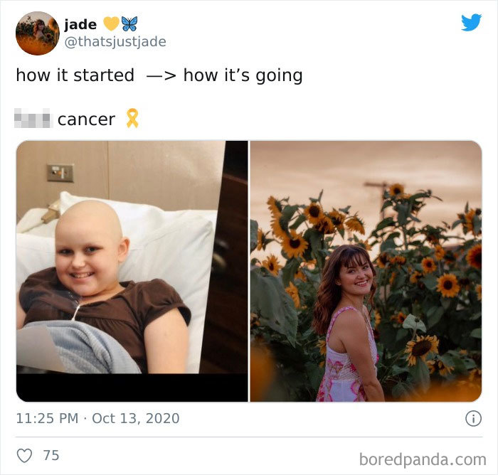 People Take ‘How It Started Vs. How It’s Going’ Challenge To Another Level Of Wholesomeness By Sharing Their Cancer Stories (30 Pics) People Take ‘How It Started Vs. How It’s Going’ Challenge To Another Level Of Wholesomeness By Sharing Their Cancer Stories (30 Pics)