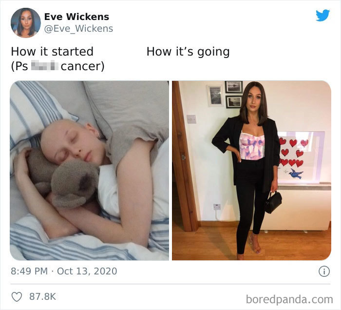 People Take ‘How It Started Vs. How It’s Going’ Challenge To Another Level Of Wholesomeness By Sharing Their Cancer Stories (30 Pics) People Take ‘How It Started Vs. How It’s Going’ Challenge To Another Level Of Wholesomeness By Sharing Their Cancer Stories (30 Pics)