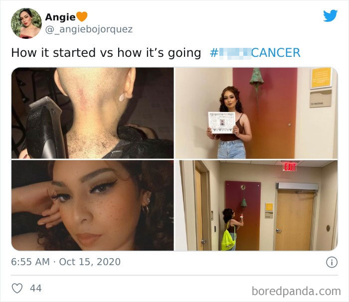 People Take ‘How It Started Vs. How It’s Going’ Challenge To Another Level Of Wholesomeness By Sharing Their Cancer Stories (30 Pics) People Take ‘How It Started Vs. How It’s Going’ Challenge To Another Level Of Wholesomeness By Sharing Their Cancer Stories (30 Pics)