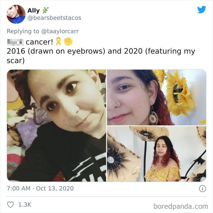 People Take ‘How It Started Vs. How It’s Going’ Challenge To Another Level Of Wholesomeness By Sharing Their Cancer Stories (30 Pics) People Take ‘How It Started Vs. How It’s Going’ Challenge To Another Level Of Wholesomeness By Sharing Their Cancer Stories (30 Pics)