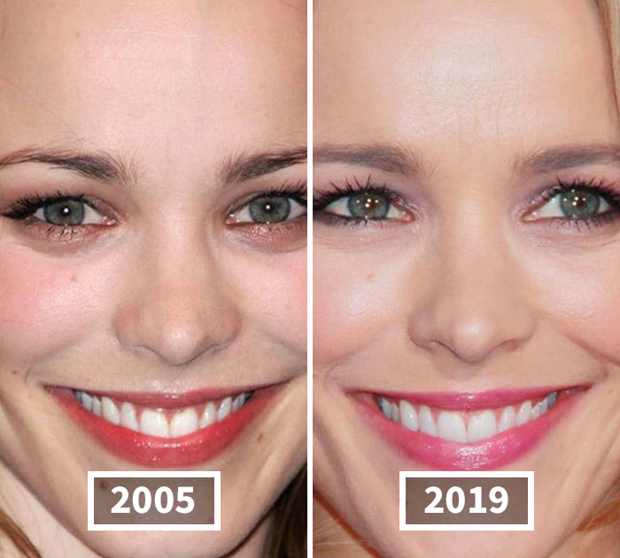 This Instagram Account Points Out How Much Celebrity Faces Have Changed Over The Years And Here Are 30 Of The Transformations