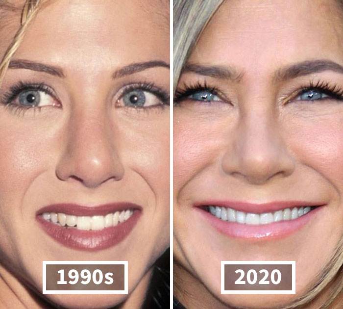 This Instagram Account Points Out How Much Celebrity Faces Have Changed Over The Years And Here Are 30 Of The Transformations