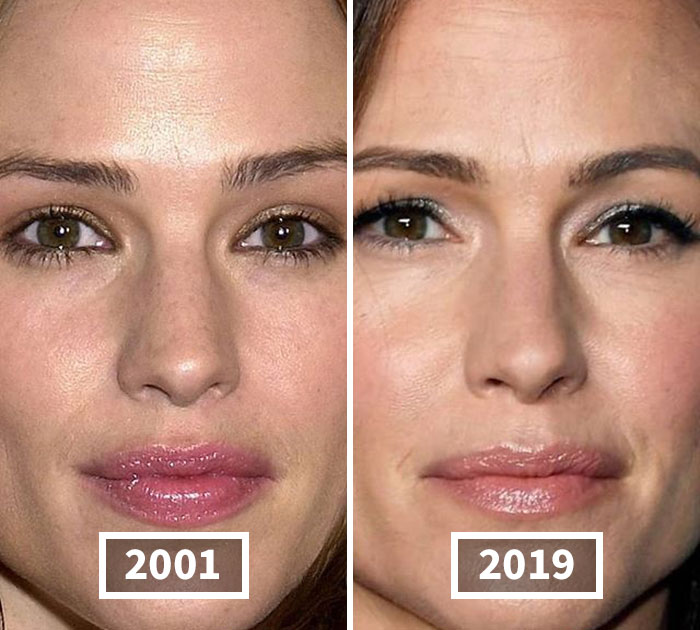 This Instagram Account Points Out How Much Celebrity Faces Have Changed Over The Years And Here Are 30 Of The Transformations