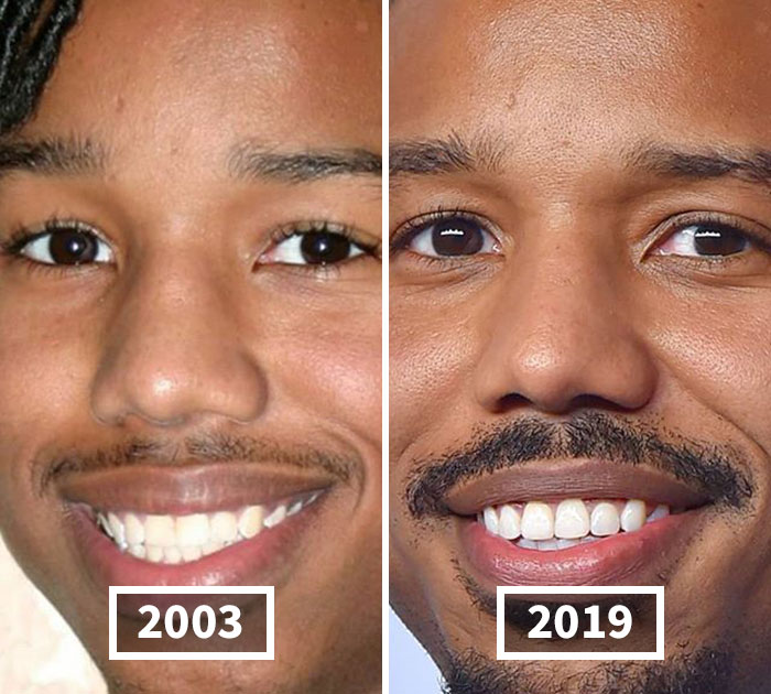 This Instagram Account Points Out How Much Celebrity Faces Have Changed Over The Years And Here Are 30 Of The Transformations