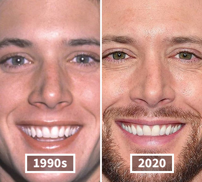 This Instagram Account Points Out How Much Celebrity Faces Have Changed Over The Years And Here Are 30 Of The Transformations