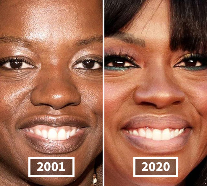 This Instagram Account Points Out How Much Celebrity Faces Have Changed Over The Years And Here Are 30 Of The Transformations