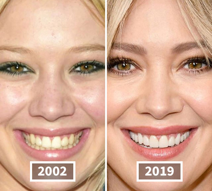 This Instagram Account Points Out How Much Celebrity Faces Have Changed Over The Years And Here Are 30 Of The Transformations