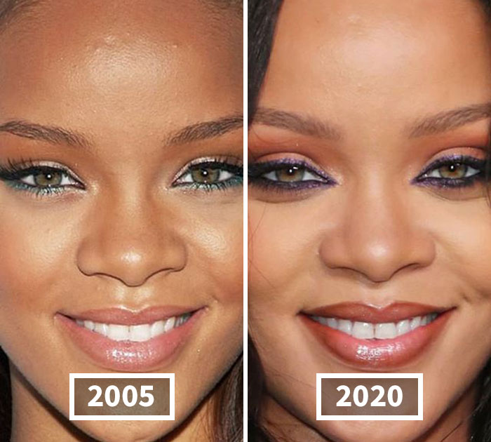 This Instagram Account Points Out How Much Celebrity Faces Have Changed Over The Years And Here Are 30 Of The Transformations
