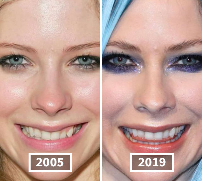 This Instagram Account Points Out How Much Celebrity Faces Have Changed Over The Years And Here Are 30 Of The Transformations
