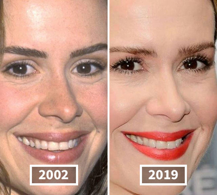 This Instagram Account Points Out How Much Celebrity Faces Have Changed Over The Years And Here Are 30 Of The Transformations