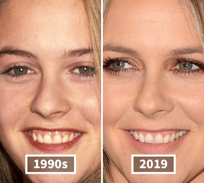 This Instagram Account Points Out How Much Celebrity Faces Have Changed Over The Years And Here Are 30 Of The Transformations