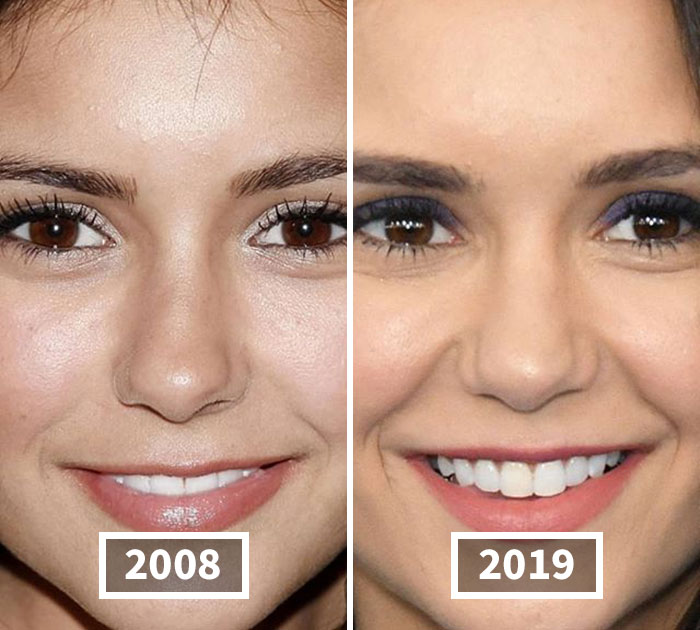 This Instagram Account Points Out How Much Celebrity Faces Have Changed Over The Years And Here Are 30 Of The Transformations