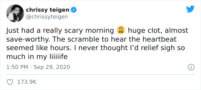 Chrissy Teigen Suffers A Miscarriage, People Support Her And Say She Helped Other Mothers Feel Less Alone Chrissy Teigen Suffers A Miscarriage, People Support Her And Say She Helped Other Mothers Feel Less Alone