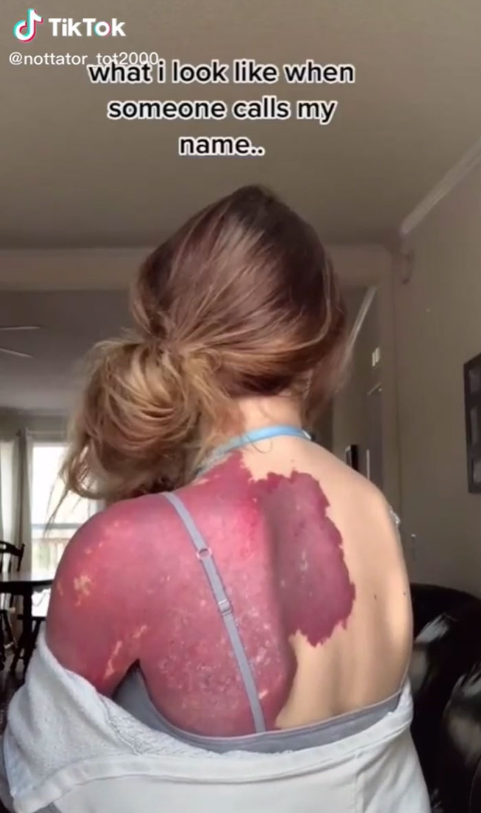 ‘There’s Nothing Positive About This’: Guy Explains How People Should Not Celebrate ‘Plus Size’ Bodies ‘There’s Nothing Positive About This’: Guy Explains How People Should Not Celebrate ‘Plus Size’ Bodies