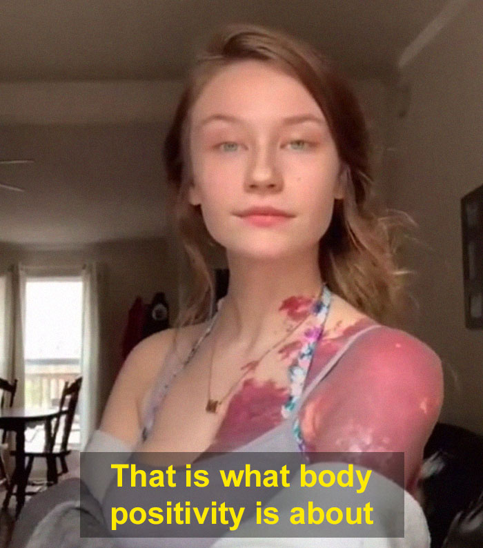 ‘There’s Nothing Positive About This’: Guy Explains How People Should Not Celebrate ‘Plus Size’ Bodies ‘There’s Nothing Positive About This’: Guy Explains How People Should Not Celebrate ‘Plus Size’ Bodies