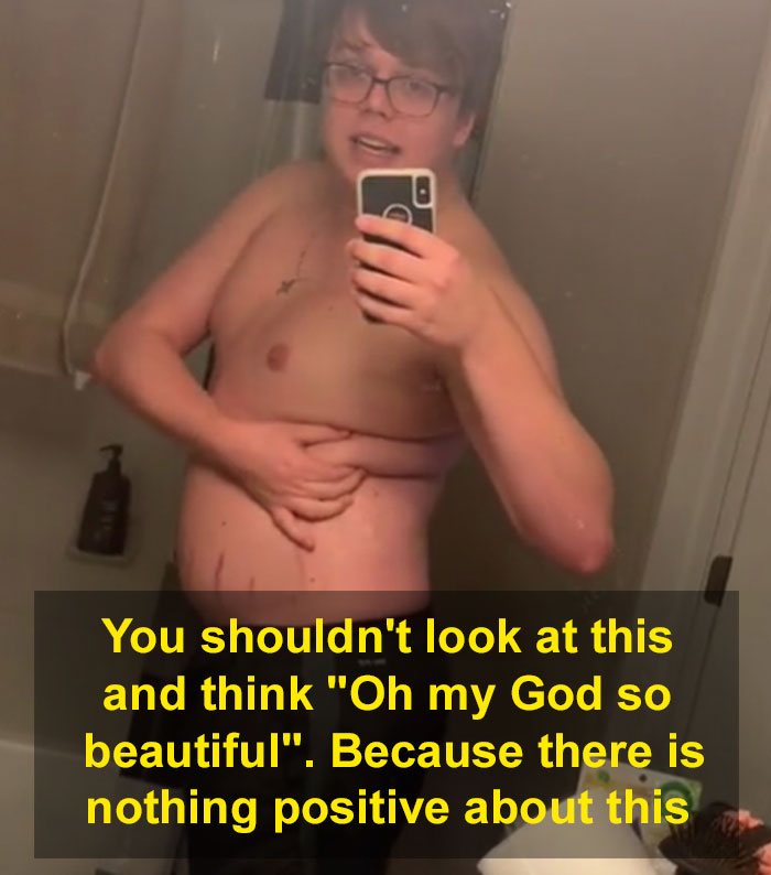 ‘There’s Nothing Positive About This’: Guy Explains How People Should Not Celebrate ‘Plus Size’ Bodies ‘There’s Nothing Positive About This’: Guy Explains How People Should Not Celebrate ‘Plus Size’ Bodies