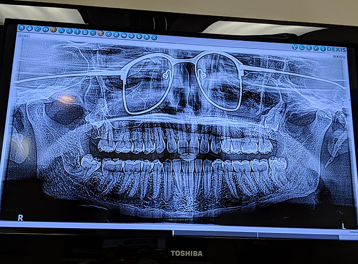 50 Times People X-Rayed Things And Got Interesting Results