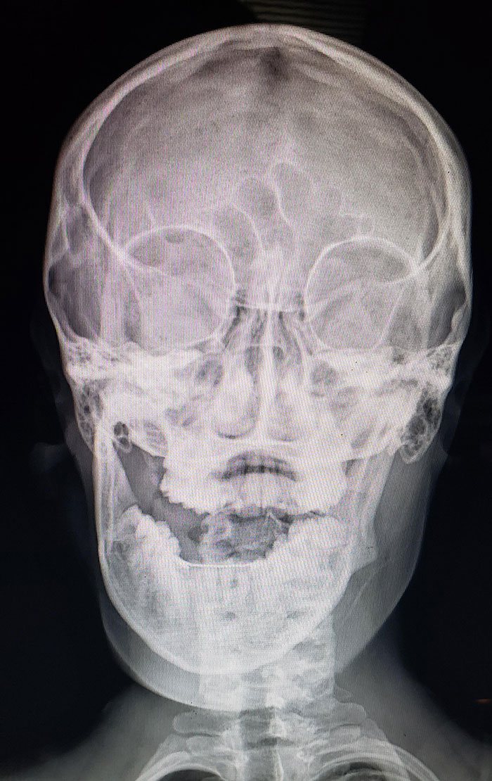 50 Times People X-Rayed Things And Got Interesting Results