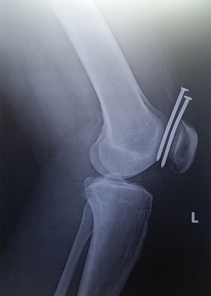 50 Times People X-Rayed Things And Got Interesting Results