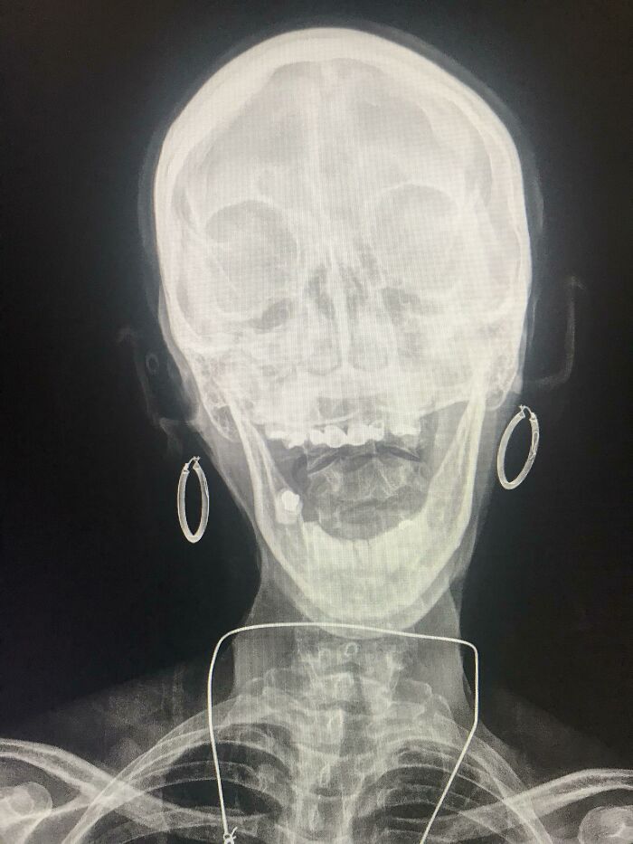 50 Times People X-Rayed Things And Got Interesting Results