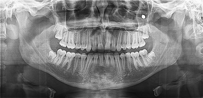 50 Times People X-Rayed Things And Got Interesting Results