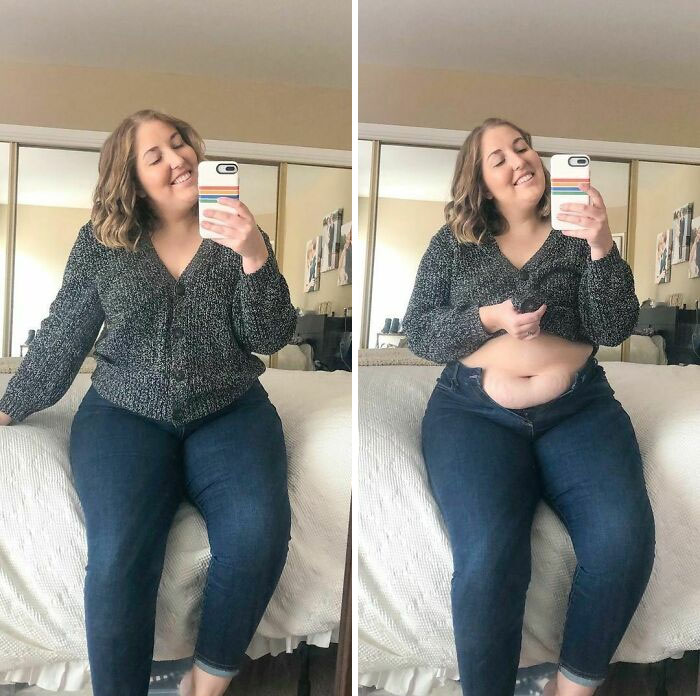 41 Women Post Unedited Pics To “Normalize Normal Bodies”