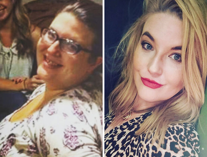 30 “Ugly Ducklings” Share Their Incredible Transformations Into Beautiful Swans (New Pics)