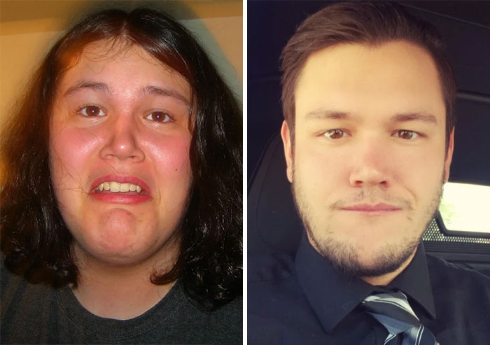 30 “Ugly Ducklings” Share Their Incredible Transformations Into Beautiful Swans (New Pics)