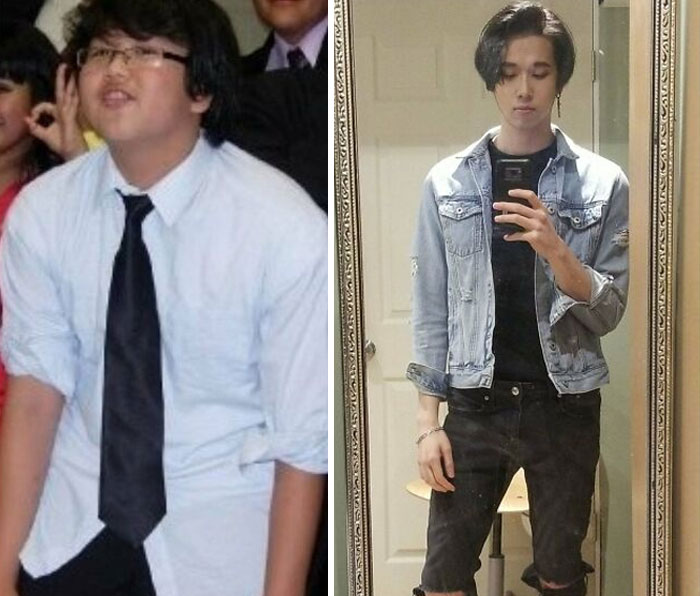 30 “Ugly Ducklings” Share Their Incredible Transformations Into Beautiful Swans (New Pics)