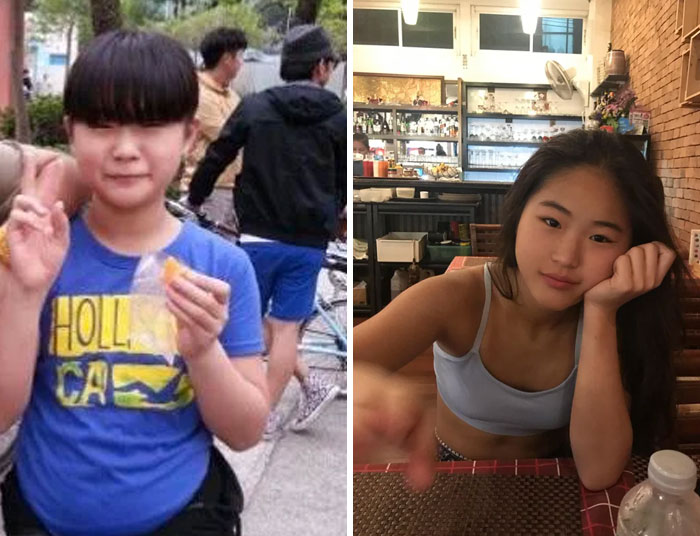 30 “Ugly Ducklings” Share Their Incredible Transformations Into Beautiful Swans (New Pics)