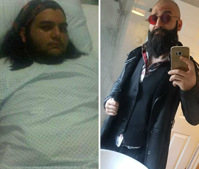 30 “Ugly Ducklings” Share Their Incredible Transformations Into Beautiful Swans (New Pics)