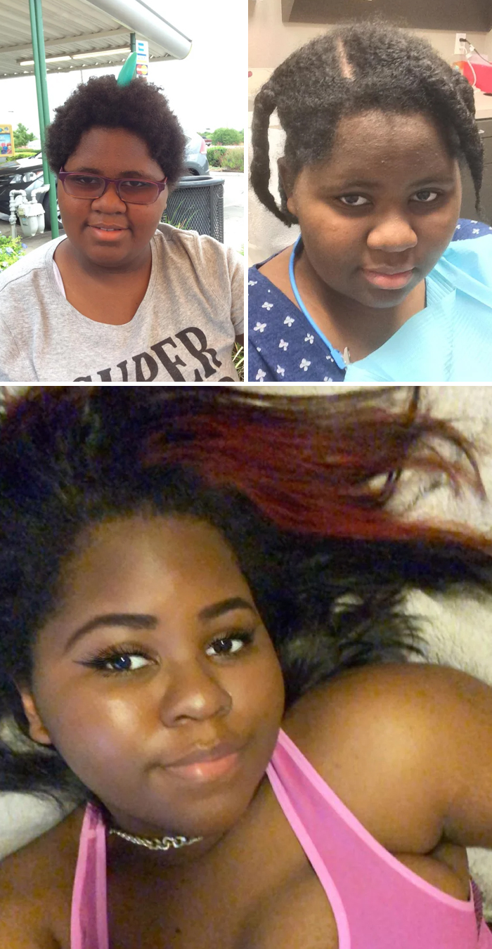 30 “Ugly Ducklings” Share Their Incredible Transformations Into Beautiful Swans (New Pics)