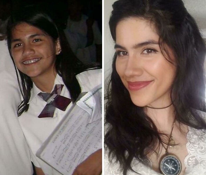 30 “Ugly Ducklings” Share Their Incredible Transformations Into Beautiful Swans (New Pics)