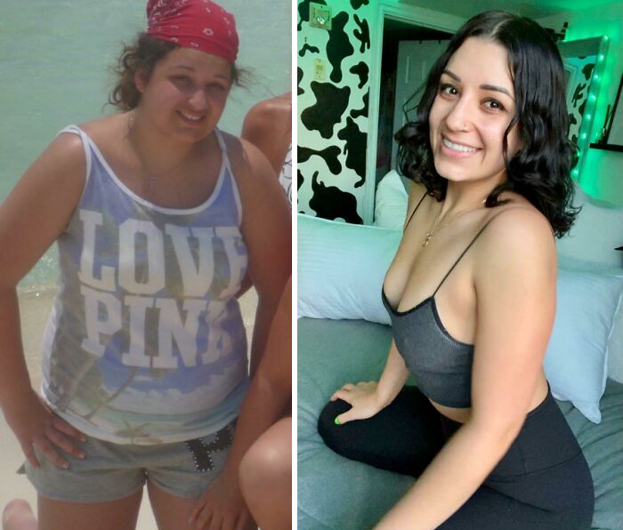 30 “Ugly Ducklings” Share Their Incredible Transformations Into Beautiful Swans (New Pics)