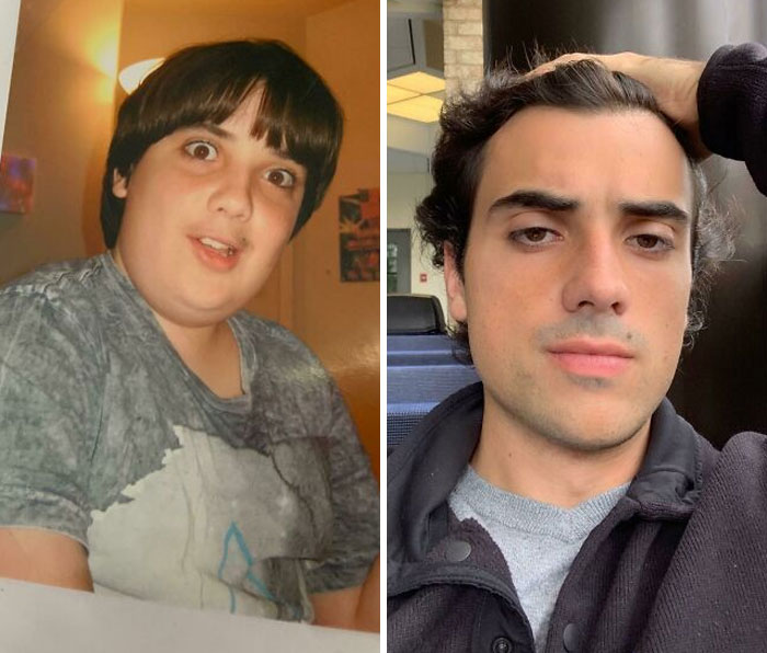 30 “Ugly Ducklings” Share Their Incredible Transformations Into Beautiful Swans (New Pics)