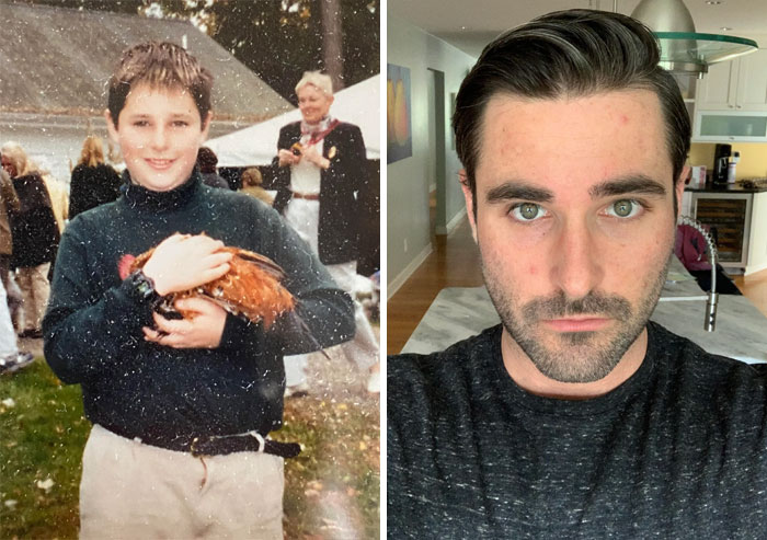 30 “Ugly Ducklings” Share Their Incredible Transformations Into Beautiful Swans (New Pics)