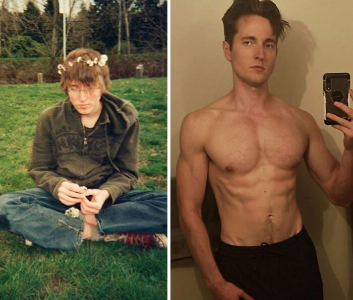 30 “Ugly Ducklings” Share Their Incredible Transformations Into Beautiful Swans (New Pics)