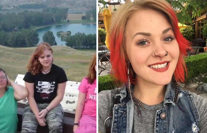 30 “Ugly Ducklings” Share Their Incredible Transformations Into Beautiful Swans (New Pics)