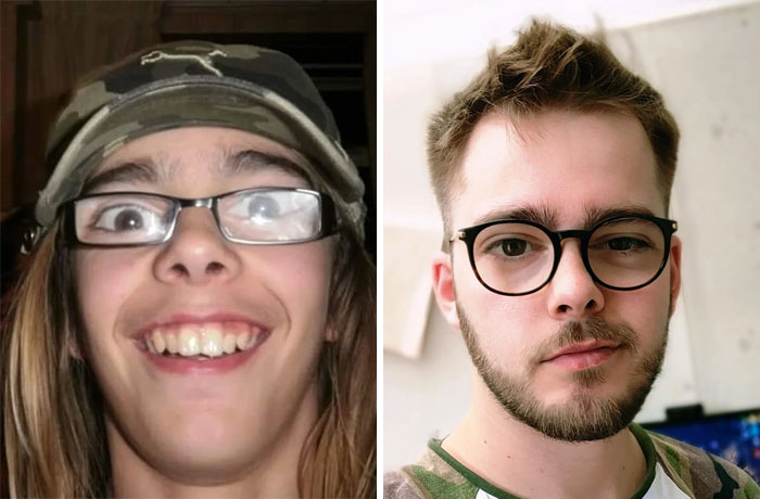 30 “Ugly Ducklings” Share Their Incredible Transformations Into Beautiful Swans (New Pics)