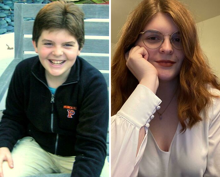 30 “Ugly Ducklings” Share Their Incredible Transformations Into Beautiful Swans (New Pics)