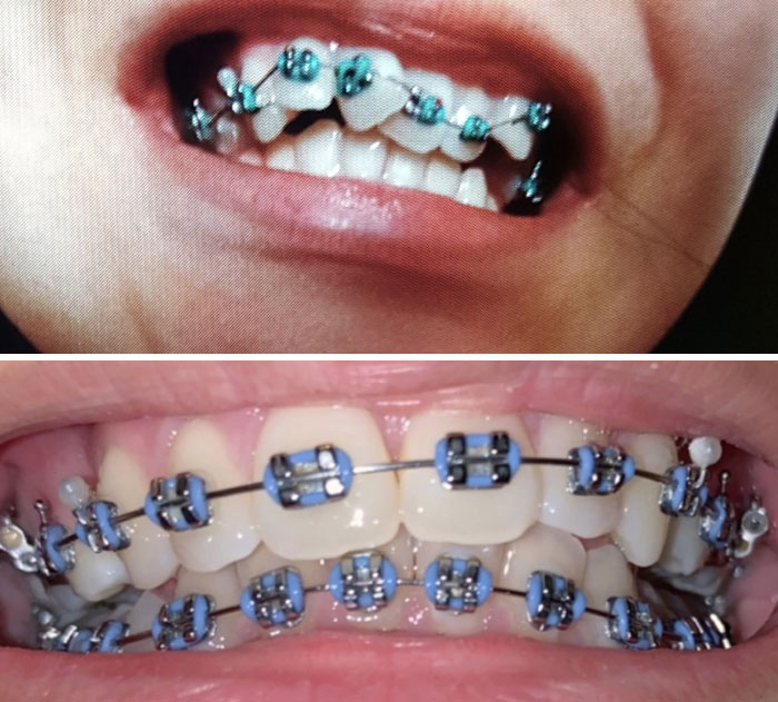 50 Interesting Comparison Images To Give You A New Perspective On Things 50 Interesting Comparison Images To Give You A New Perspective On Things