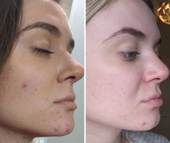 Women Join The #FilterDrop Challenge On Instagram, Share 22 Unfiltered Faces To Fight Against Retouched Paid Beauty Ads Women Join The #FilterDrop Challenge On Instagram, Share 22 Unfiltered Faces To Fight Against Retouched Paid Beauty Ads