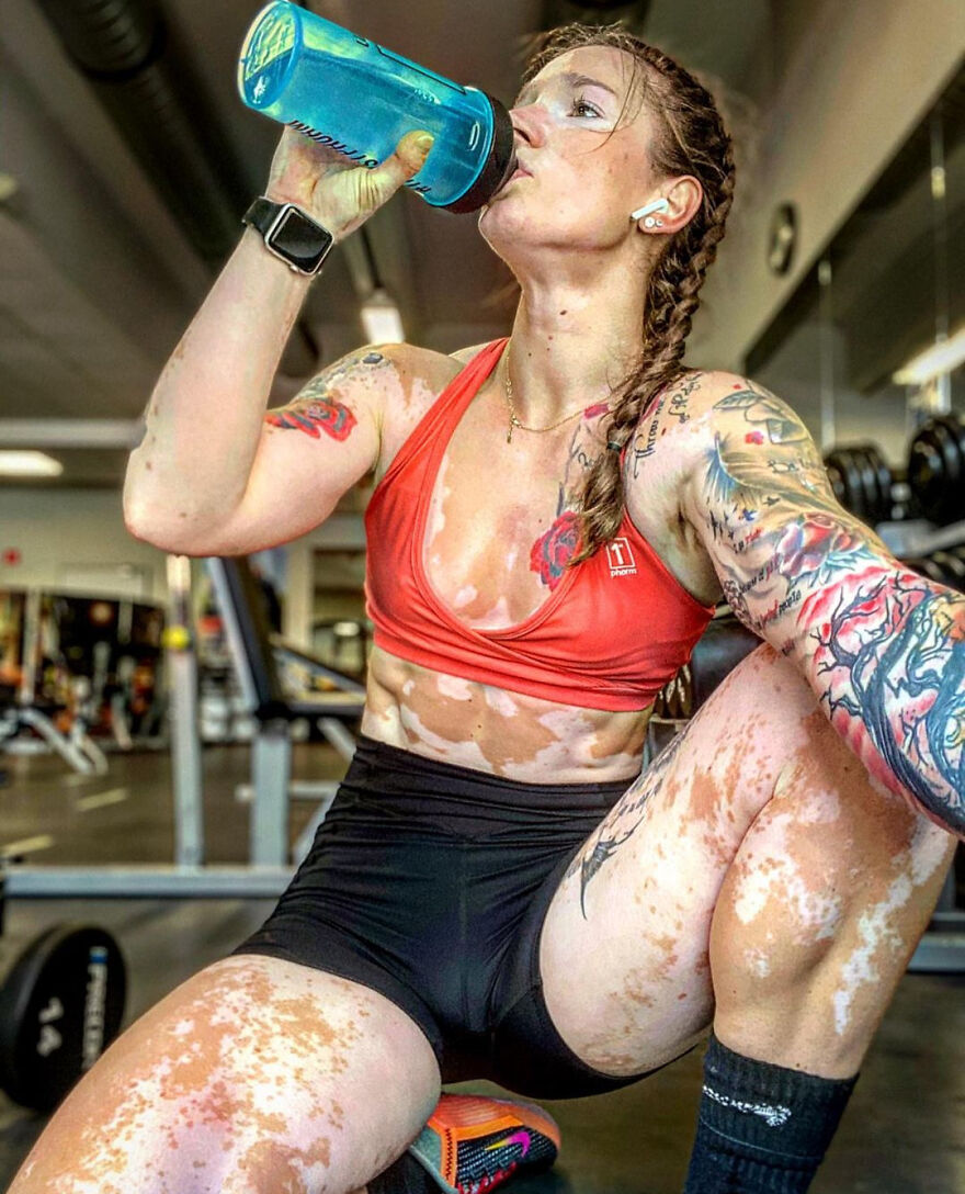 This Woman From Utah Learned To Accept Her Vitiligo Through Fitness And Weightlifting This Woman From Utah Learned To Accept Her Vitiligo Through Fitness And Weightlifting