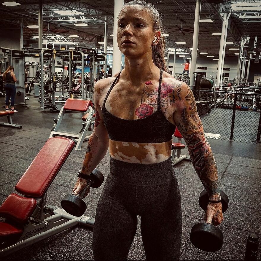 This Woman From Utah Learned To Accept Her Vitiligo Through Fitness And Weightlifting This Woman From Utah Learned To Accept Her Vitiligo Through Fitness And Weightlifting