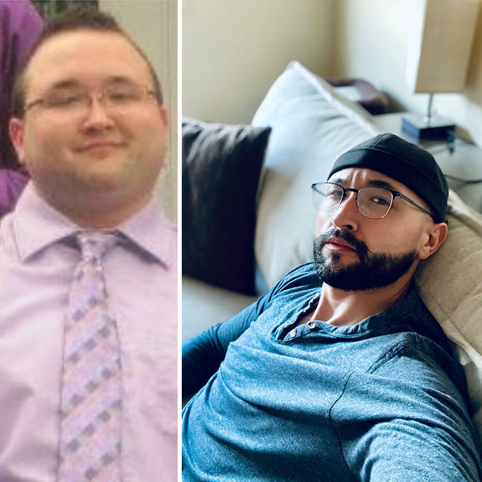 30 “Ugly Ducklings” Share Their Incredible Transformations Into Beautiful Swans (New Pics) 30 “Ugly Ducklings” Share Their Incredible Transformations Into Beautiful Swans (New Pics)